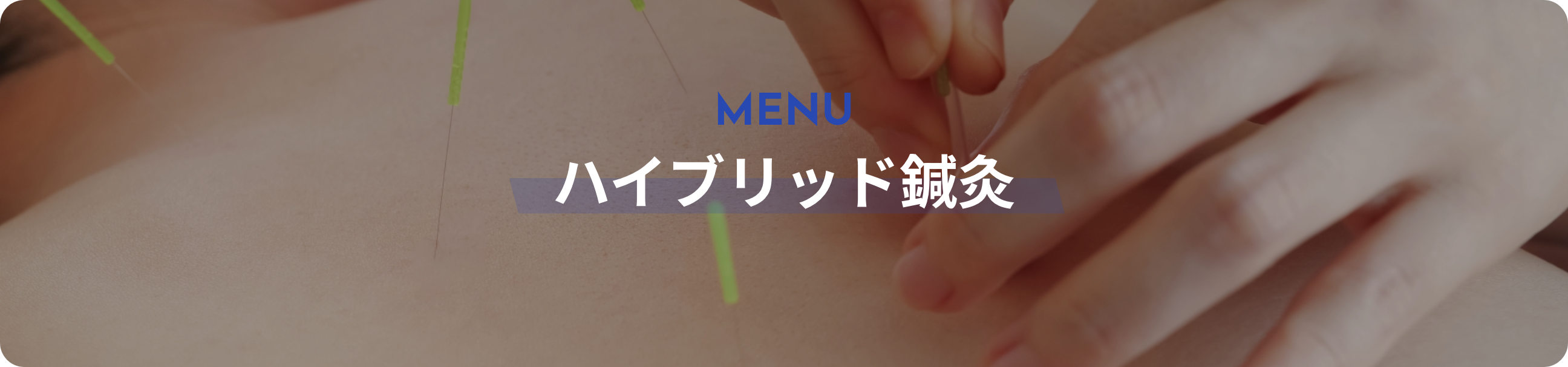 ハイブリッド鍼灸