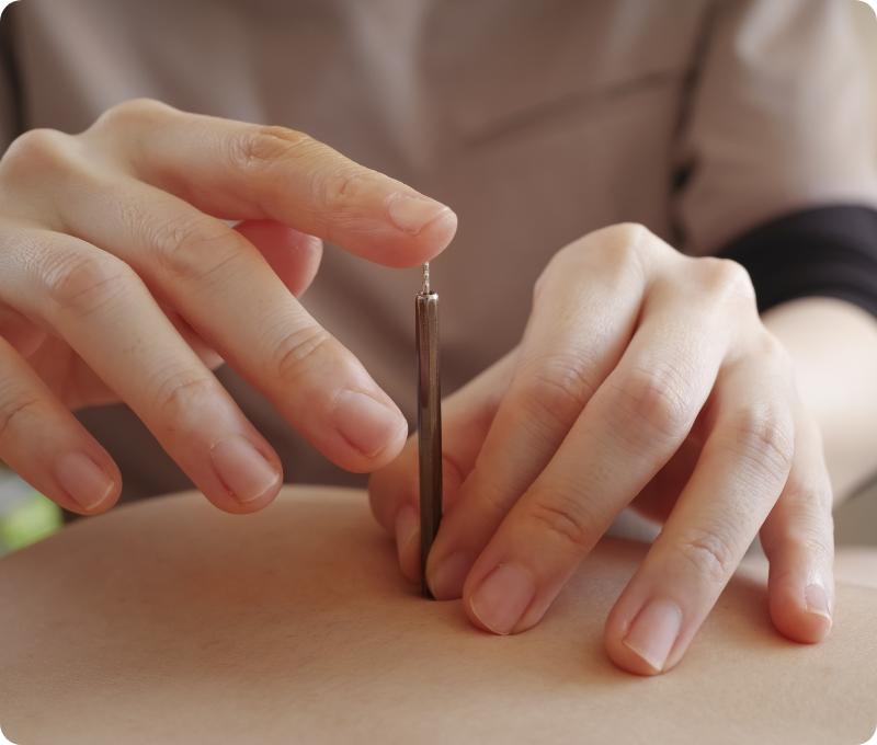 鍼灸